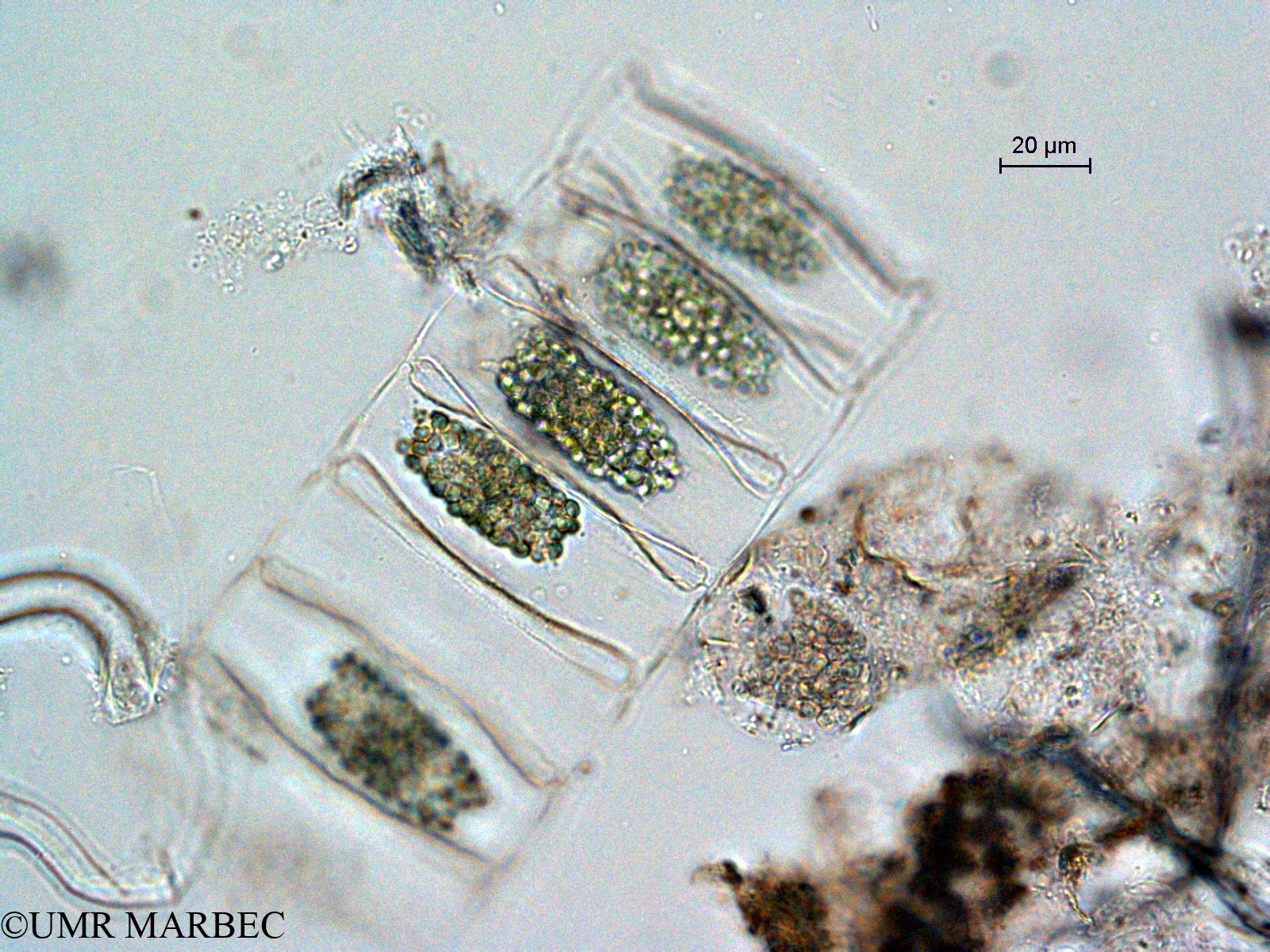 phyto/Scattered_Islands/all/COMMA April 2011/Bellerochea horologicalis (ancien Bellerochea malleus -3)(copy).jpg